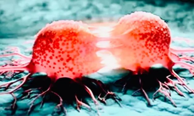 Renommierter Onkologe warnt davor, dass sich Krebs nach der Covid-Spritze schnell entwickelt – „Ich bin erfahren genug, um zu wissen, dass dies kein Zufall ist“